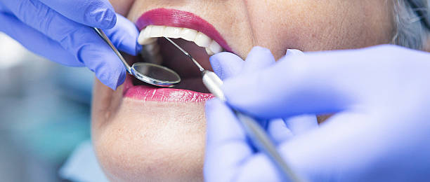 Best Emergency Root Canal Treatment in Pierceton, IN